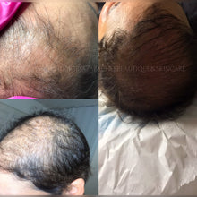 Load image into Gallery viewer, PLASMA RICO EN PLAQUETAS OFERTA 5 x1