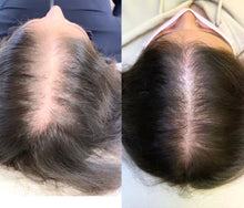 Load image into Gallery viewer, PLASMA RICO EN PLAQUETAS OFERTA 5 x1