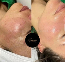 Cargar imagen en el visor de la galería, FACIAL DETOX CHANGE PEEL