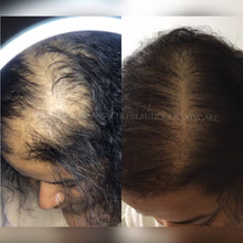 Load image into Gallery viewer, PLASMA RICO EN PLAQUETAS OFERTA 5 x1