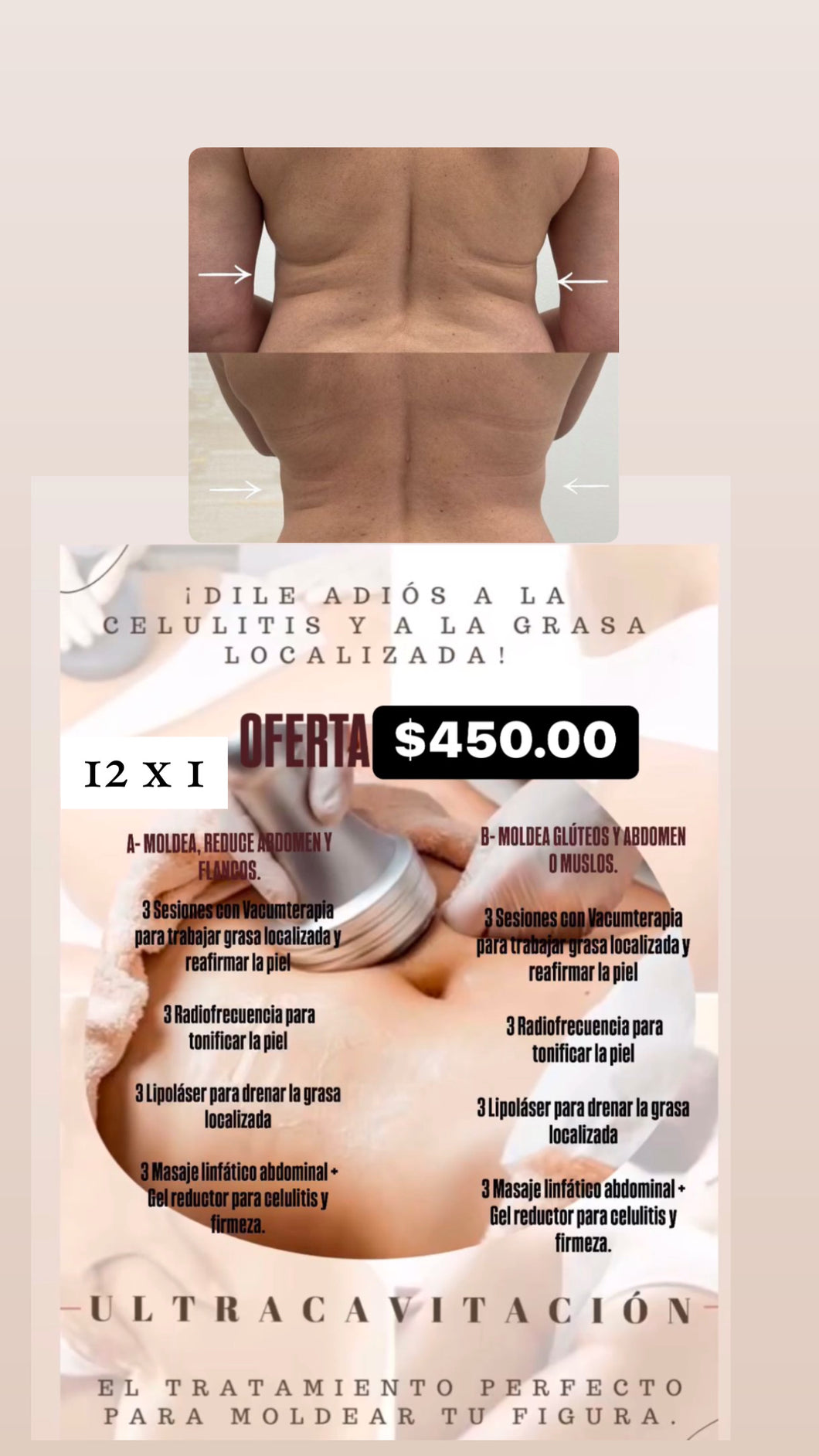MOLDEA ABDOMEN Y ESPALDA OFERTA $450.00