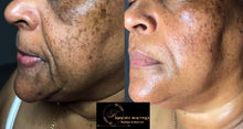 Cargar imagen en el visor de la galería, FACIAL DETOX CHANGE PEEL
